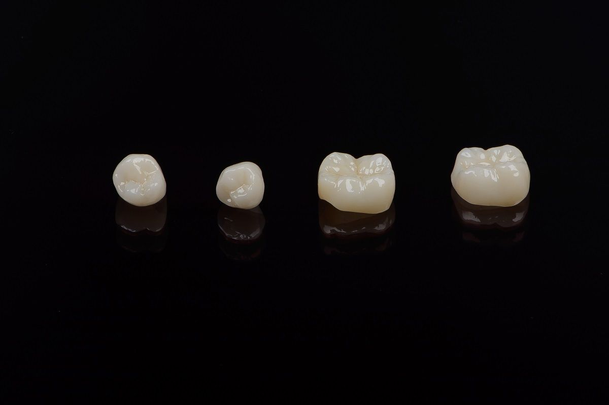 Benefits of Dental Crowns and Bridges