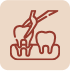 Tooth Extraction