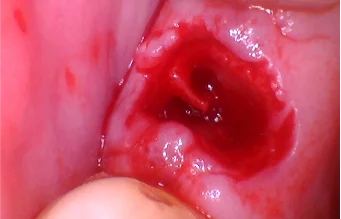Step 2